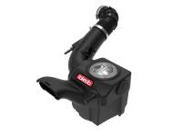 aFe Momentum GT Pro Dry S Intake System 14-15 Ford Fiesta ST L4-1.6L (t)