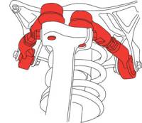 SPC Performance - SPC Performance Audi and VW Adjustable Control Arm Kit - Image 2