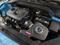 aFe Power (Advanced FLOW Engineering) - aFe 18-21 Hyundai Kona L4 2.0L Takeda Momentum Cold Air Intake System w/ Pro 5R Media - Image 6